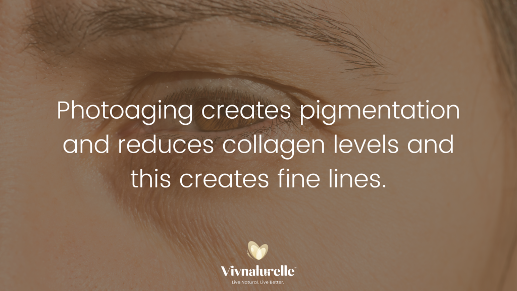 reason for fine lines under eyes